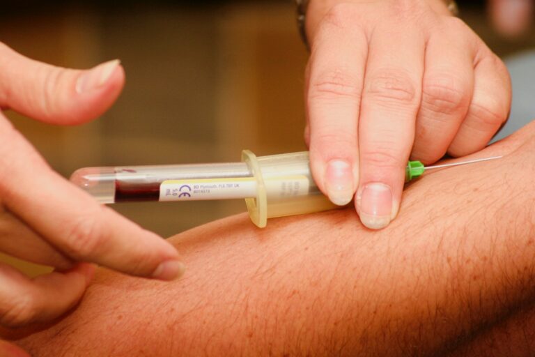 What Are the Benefits of Plasma Treatments?
